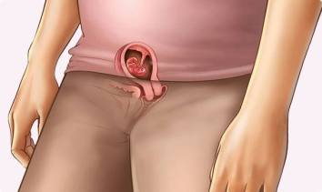 13055388_10209376844767423_8010427952719849421_n