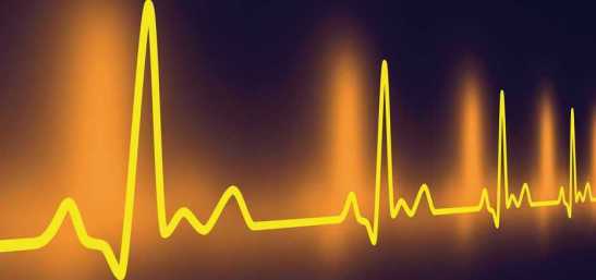 latido-con-taquicardia